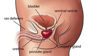 Cancro alla prostata: eiaculare almeno 21 volte al mese può prevenirlo