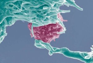 Primo anti-cancro con cellule T: però costa 400mila euro