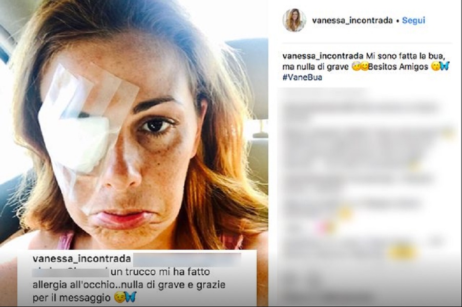 Vanessa Incontrada su Instagram con la benda sull'occhio