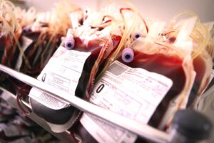 Donna morta per trasfusione di sangue infetto: Stato condannato a risarcire