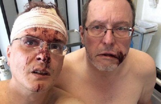 Mauro Padovani e suo marito Tom Freeman, aggressione omofoba in Belgio: sprangate dai vicini