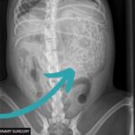 Cane ingerisce 200 grammi di elastici per capelli: la foto ai raggi X