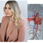 Cos'è l'embolia polmonare, la patologia che ha colpito la moglie di Maurizio Battista