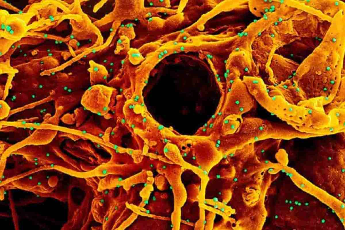 Il virus al microscopio