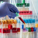 laboratorio test sangue
