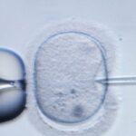 Rappresentazione della fecondazione in vitro