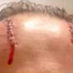 La testa ferita della poliziotta transgender