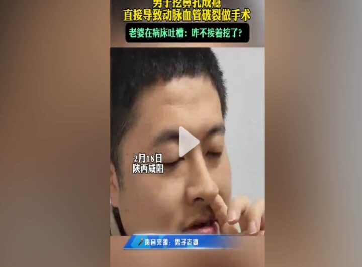 Si mette le dita nel naso, si rimpe un'arteria e viene operato d'urgenza