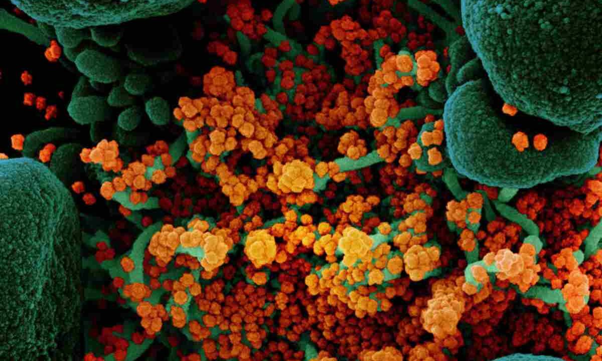 Si chiama H3N2 ed è un nuovo e pericoloso ceppo di influenza: sintomi e come prevenire l’epidemia Nella foto: Virus, una rappresentazione 3D