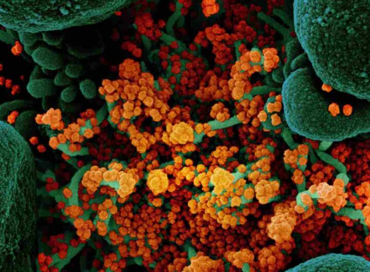 Si chiama H3N2 ed è un nuovo e pericoloso ceppo di influenza: sintomi e come prevenire l’epidemia Nella foto: Virus, una rappresentazione 3D