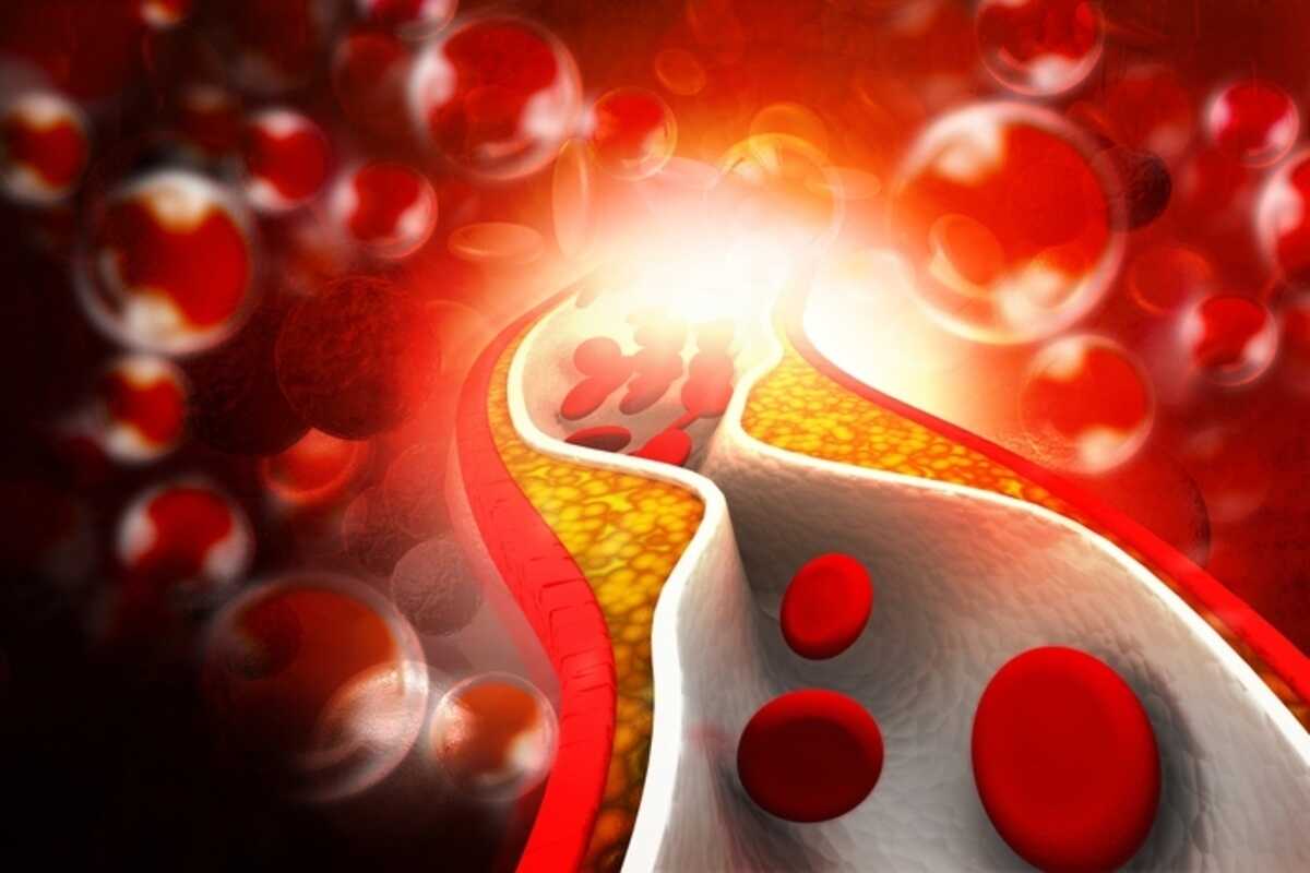Colesterolo alto: i rischi per la salute del cuore e non solo