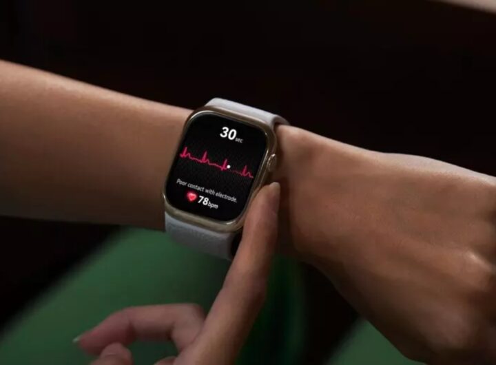 smartwatch