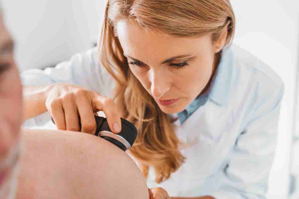 Cancro alla pelle, in Italia aumenta del 30%: la ricerca lancia l’allarme