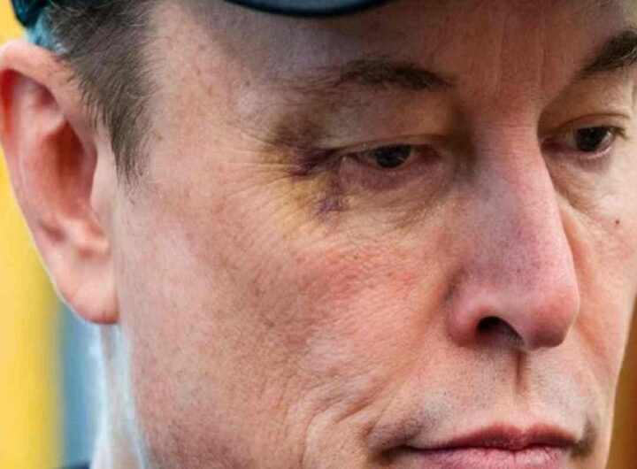 Elon Musk con l'occhio nero da Trump nel giorno dell'addio dal Doge: "È stato mio figlio"