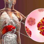 “Colpa di un mix di virus”, più di 16 milioni di casi in Italia