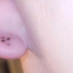 L'orecchi punto dal ragno violino