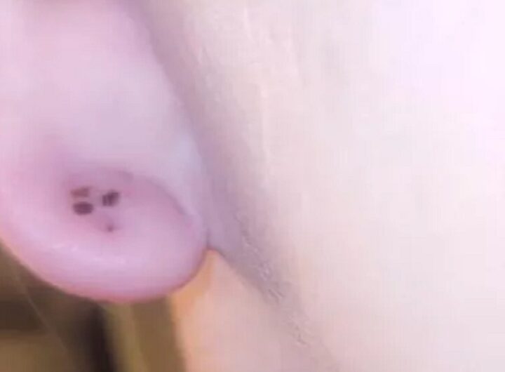 L'orecchi punto dal ragno violino