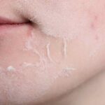 addio pelle secca con queste creme