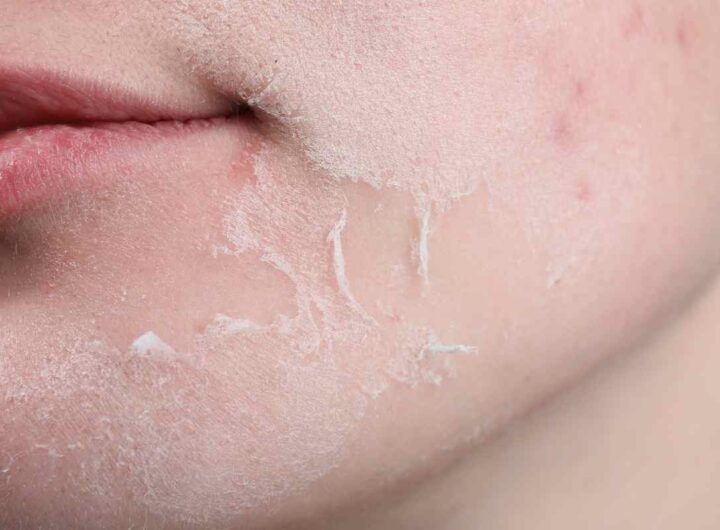 addio pelle secca con queste creme