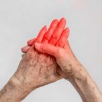 Formicolio mani cause