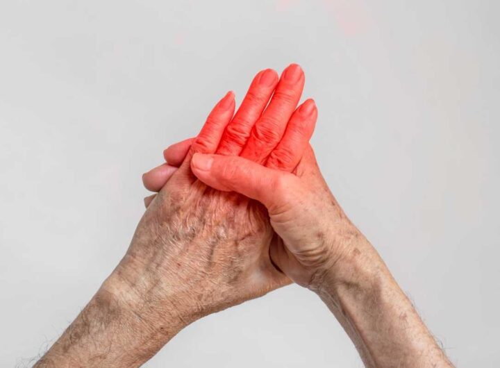 Formicolio mani cause