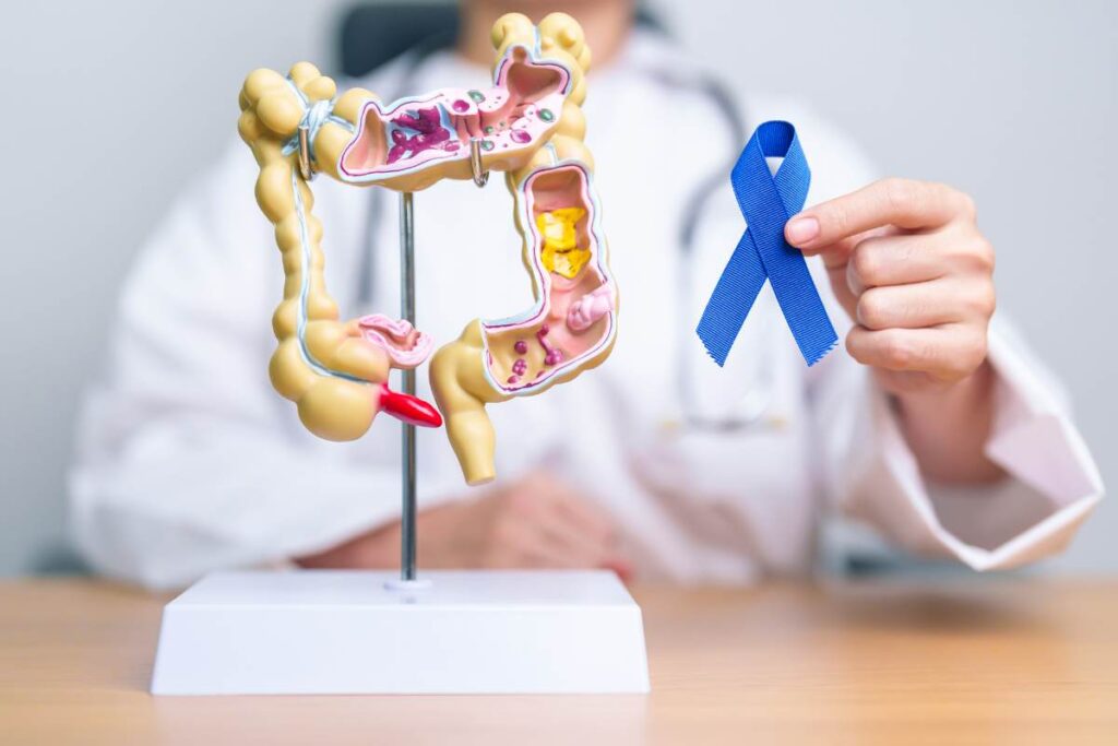 cancro al colon sintomi