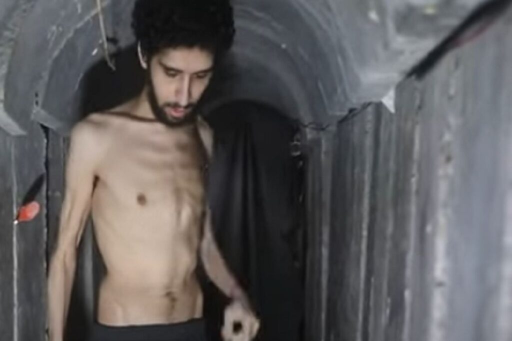 Uno dei prigionieri di Hamas ridotto carne e ossa