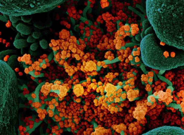 La variante Stratus del Covid