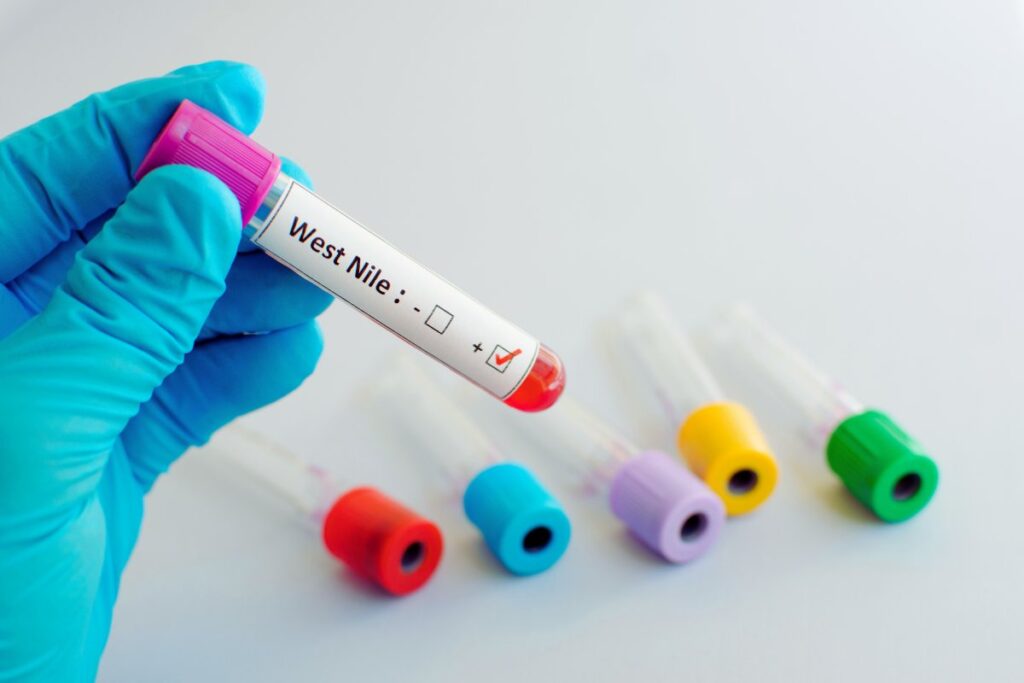 West Nile, il nuovo virus fuori controllo