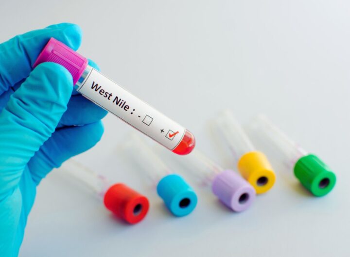 West Nile, il nuovo virus fuori controllo