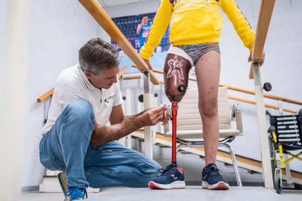 la protesi della gamba di asaad