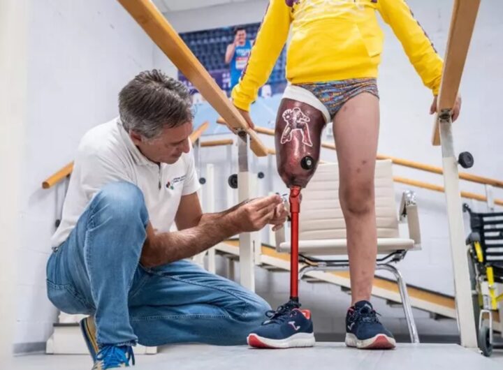 la protesi della gamba di asaad