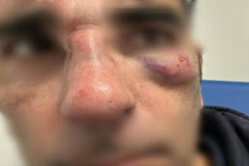 Controllore Cotral e consigliere di Fratelli d'Italia aggredito e picchiato