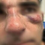 Controllore Cotral e consigliere di Fratelli d'Italia aggredito e picchiato