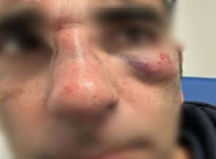 Controllore Cotral e consigliere di Fratelli d'Italia aggredito e picchiato