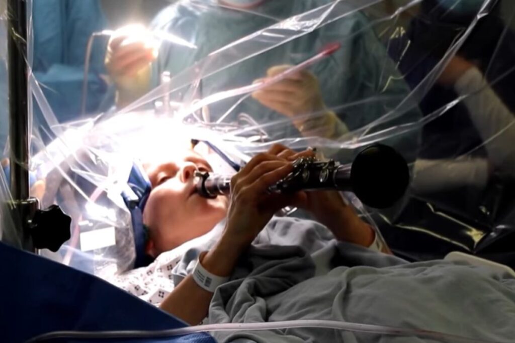 operazione al cervello