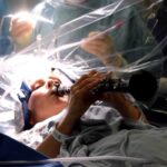 operazione al cervello