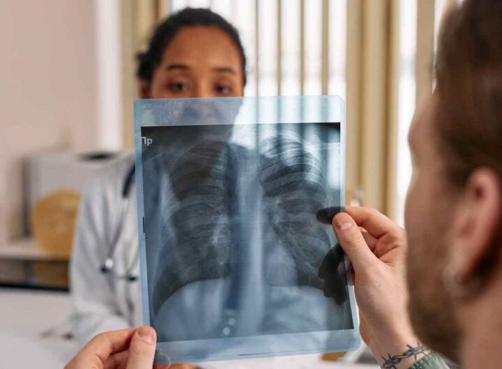 Tumore al polmone, il sintomo silenzioso che troppi ignorano conoscerlo, tutti i dettagli