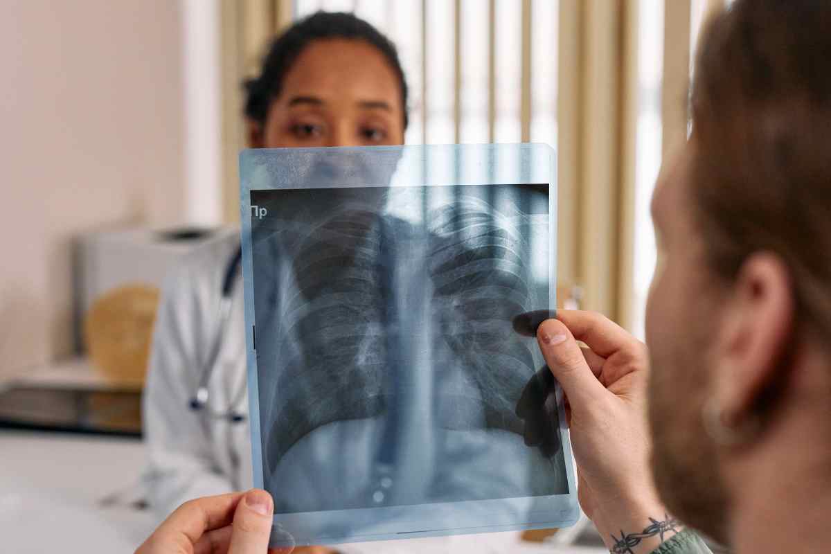 Tumore al polmone, il sintomo silenzioso che troppi ignorano conoscerlo può salvarti la vita