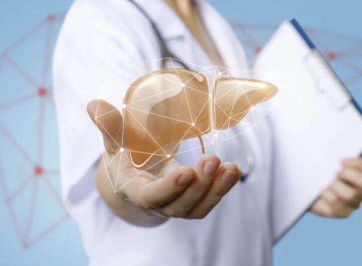 La MASLD, comunemente nota come "fegato grasso", è una condizione caratterizzata dall’accumulo di grasso nel fegato in assenza di abuso alcolico significativo.