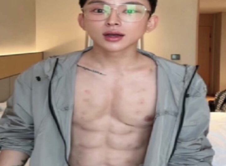 Addominali finti con iniezioni di acido ialuronico