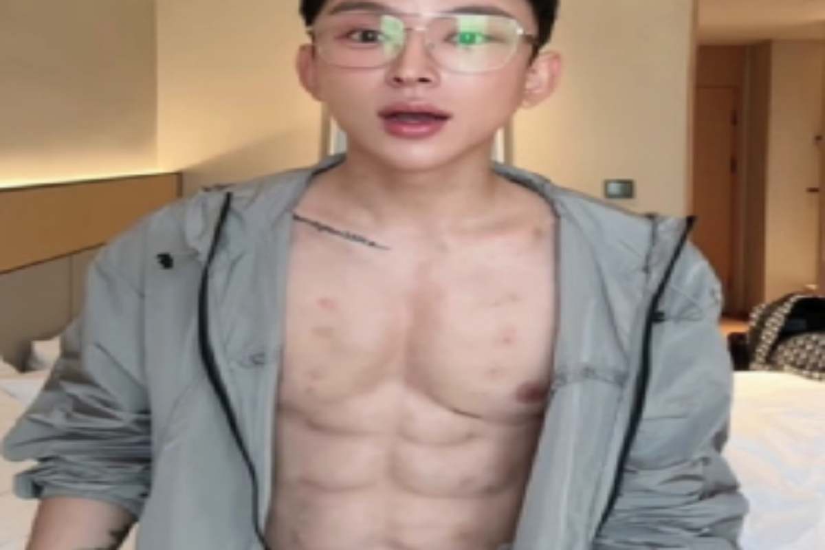 Il genio del giorno, l’influencer che ha speso 500mila euro in iniezioni di acido ialuronico per sviluppare addominali finti