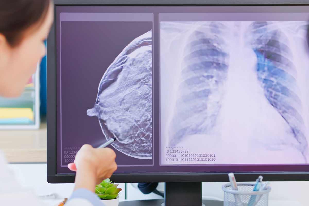 Cancro, scordati queste bevande: ti uccidono lentamente