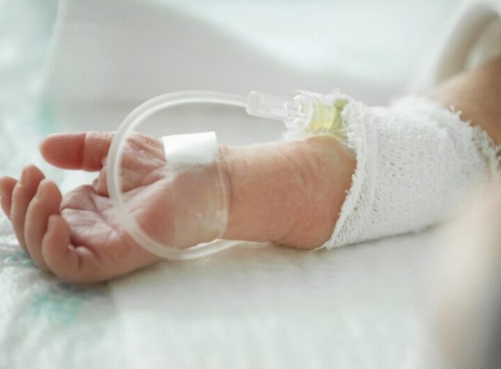 neonato ricoverato