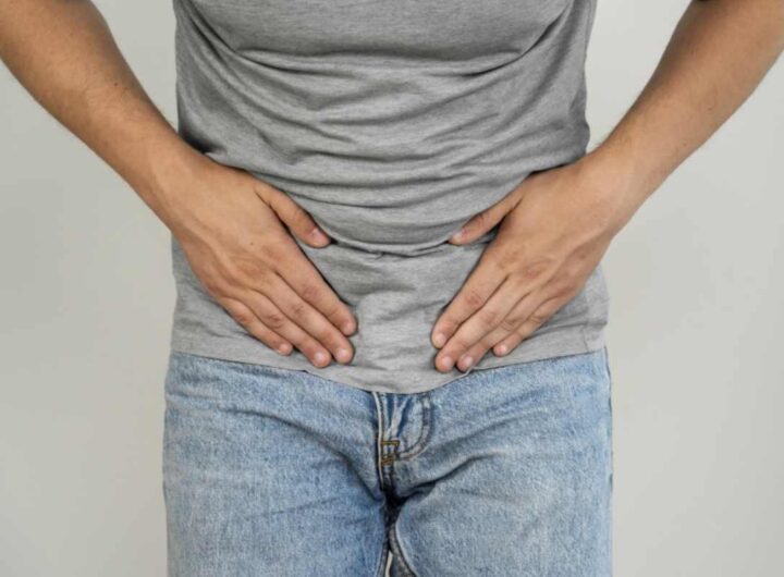 Si tratta di una forma di ernia inguinale che, a differenza delle più comuni ernie riducibili, presenta un contenuto erniario bloccato all’interno del sacco,