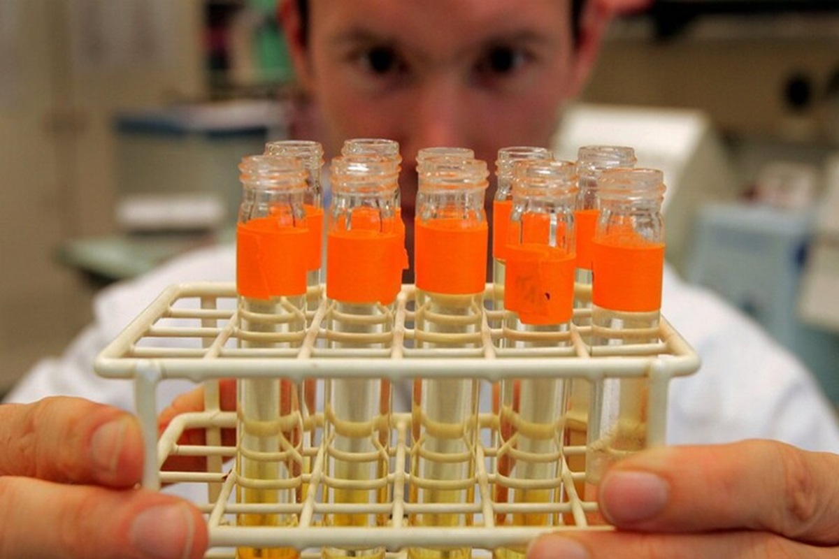 Il test delle urine in grado di stimare la tua età biologica