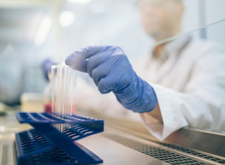 Ricercatore analizza campioni di sangue in laboratorio per studi sul diabete di tipo 1