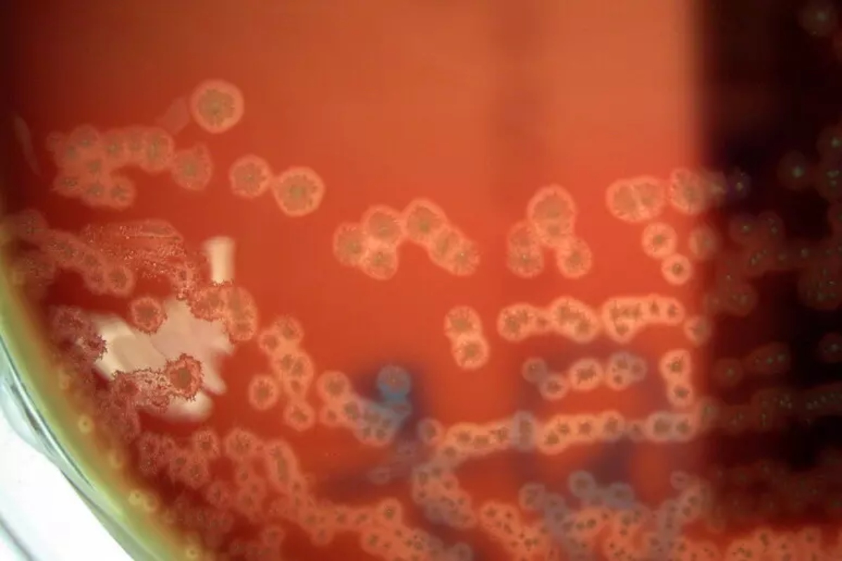 batteri mangia tumori