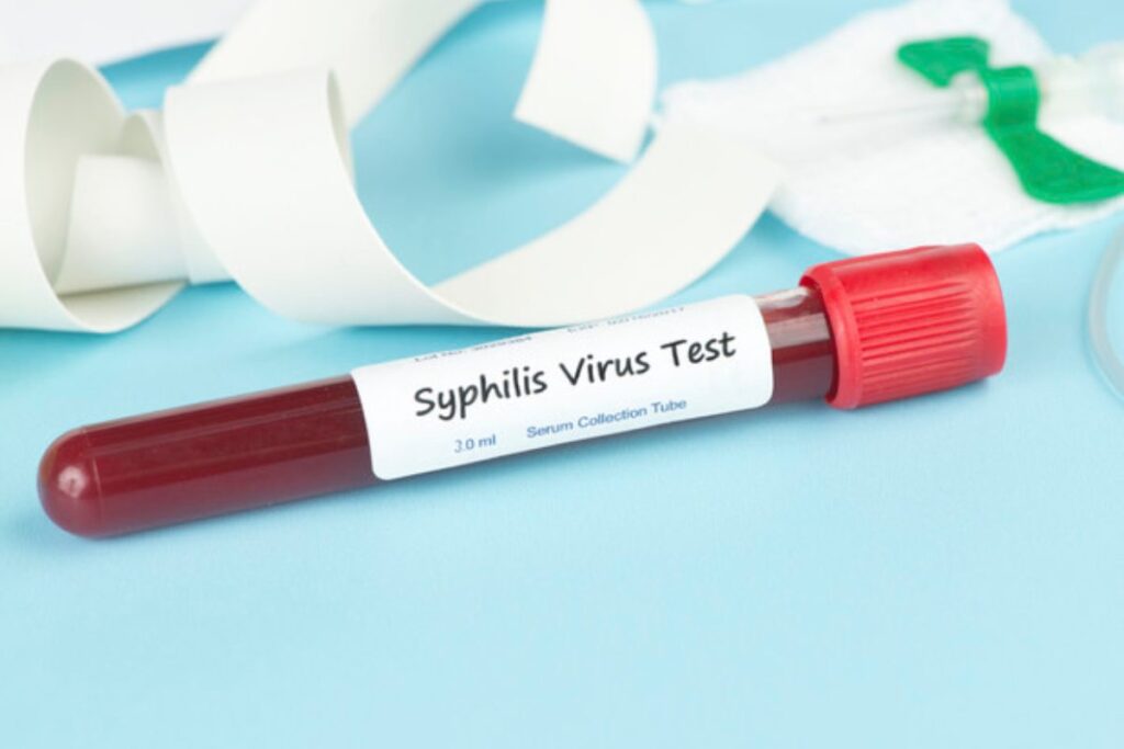 test sifilide