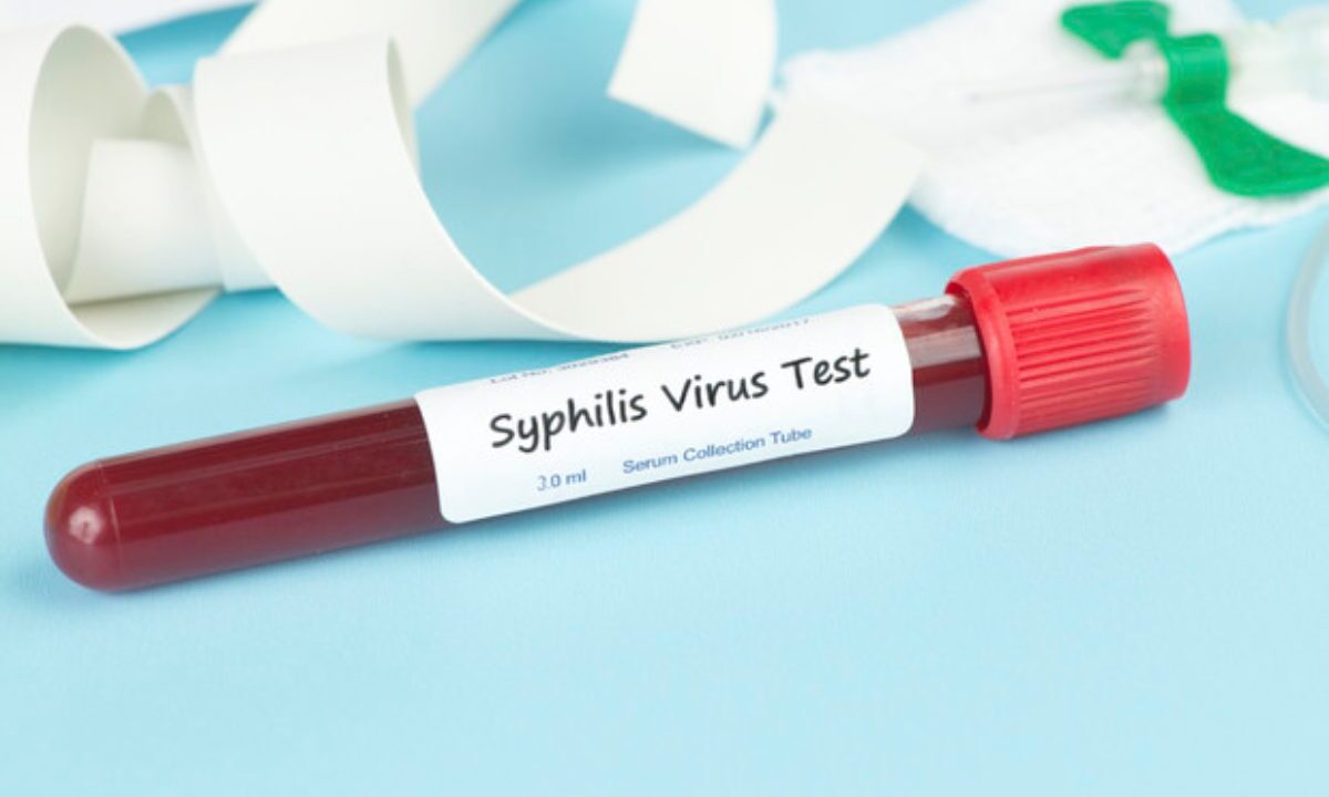 test sifilide